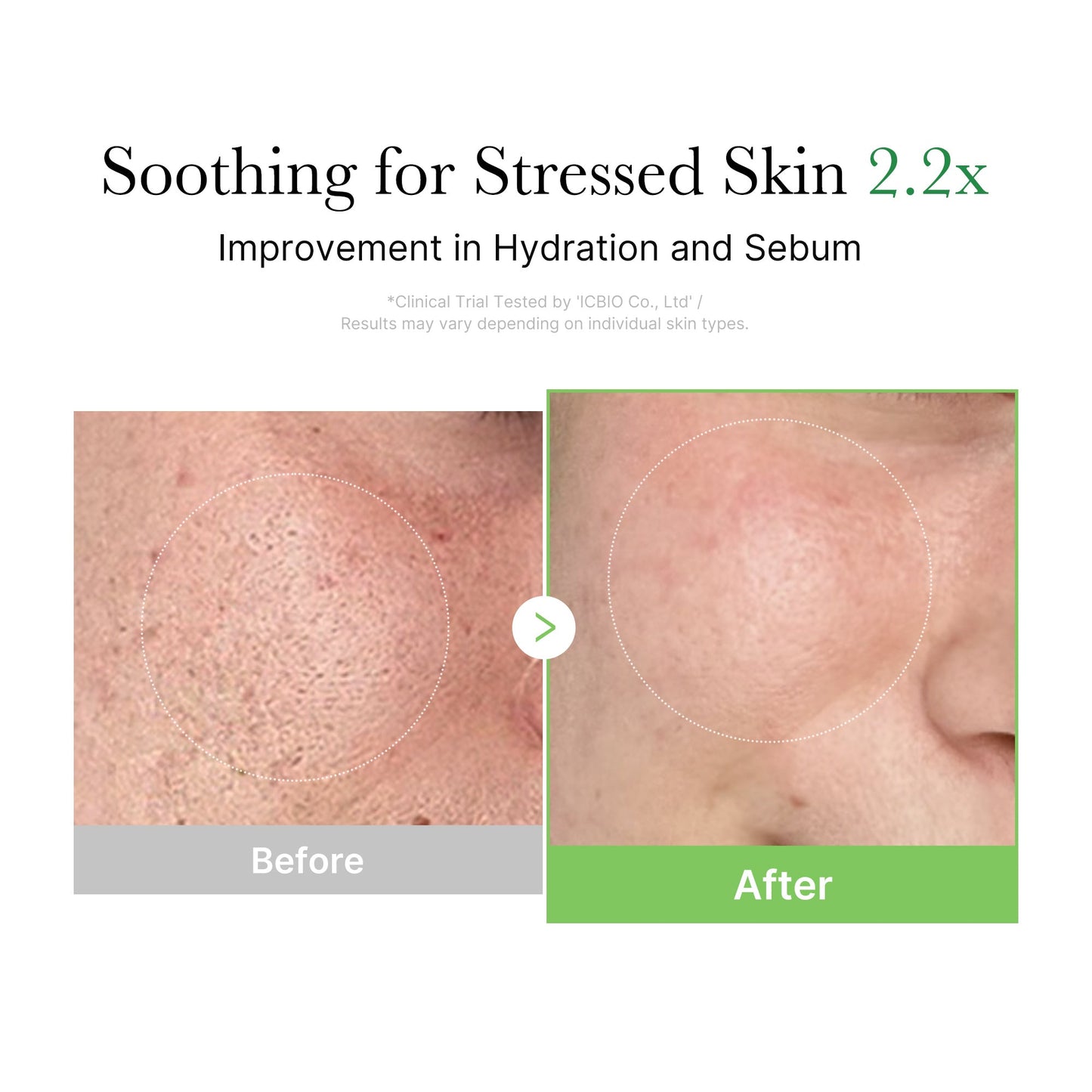 [GIFT] Exosome Cica Calming Cream
