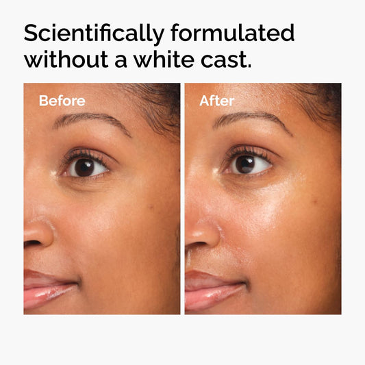 The Ordinary UV Filters SPF 45 Serum Sunscreen for Face, Lightweight Hydrating Broad-Spectrum Sunscreen, UVA/UVB Protection, Non-Comedogenic, No White Cast, 2 Fl Oz
