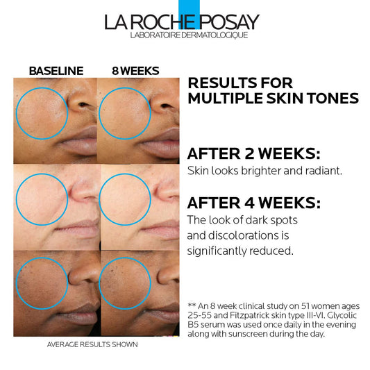 La Roche-Posay Glycolic Acid Serum with Tranexamic Acid, Kojic Acid and Vitamin B5, Reduces Dark Spots and Discoloration, Skin Tone Corrector to Brighten and Even Skin Tone