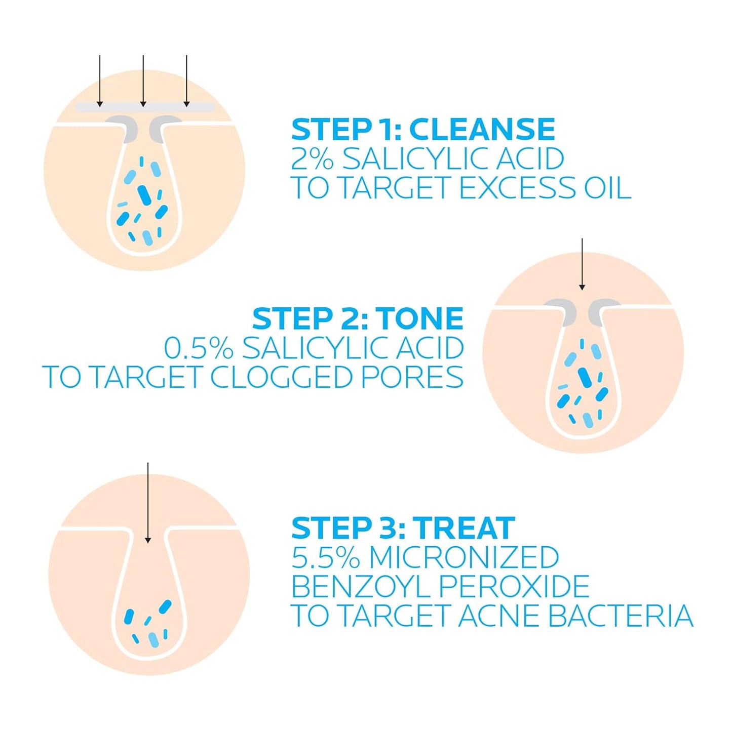 La Roche-Posay Effaclar Dermatological 3 Step Acne Treatment System, Salicylic Acid Acne Cleanser, Pore Refining Toner, and Benzoyl Peroxide Spot Treatment for Sensitive Skin