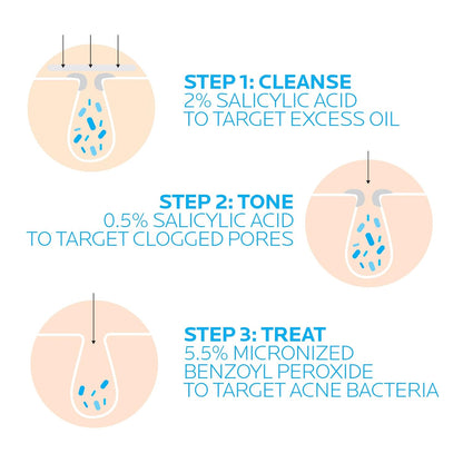 La Roche-Posay Effaclar Dermatological 3 Step Acne Treatment System, Salicylic Acid Acne Cleanser, Pore Refining Toner, and Benzoyl Peroxide Spot Treatment for Sensitive Skin