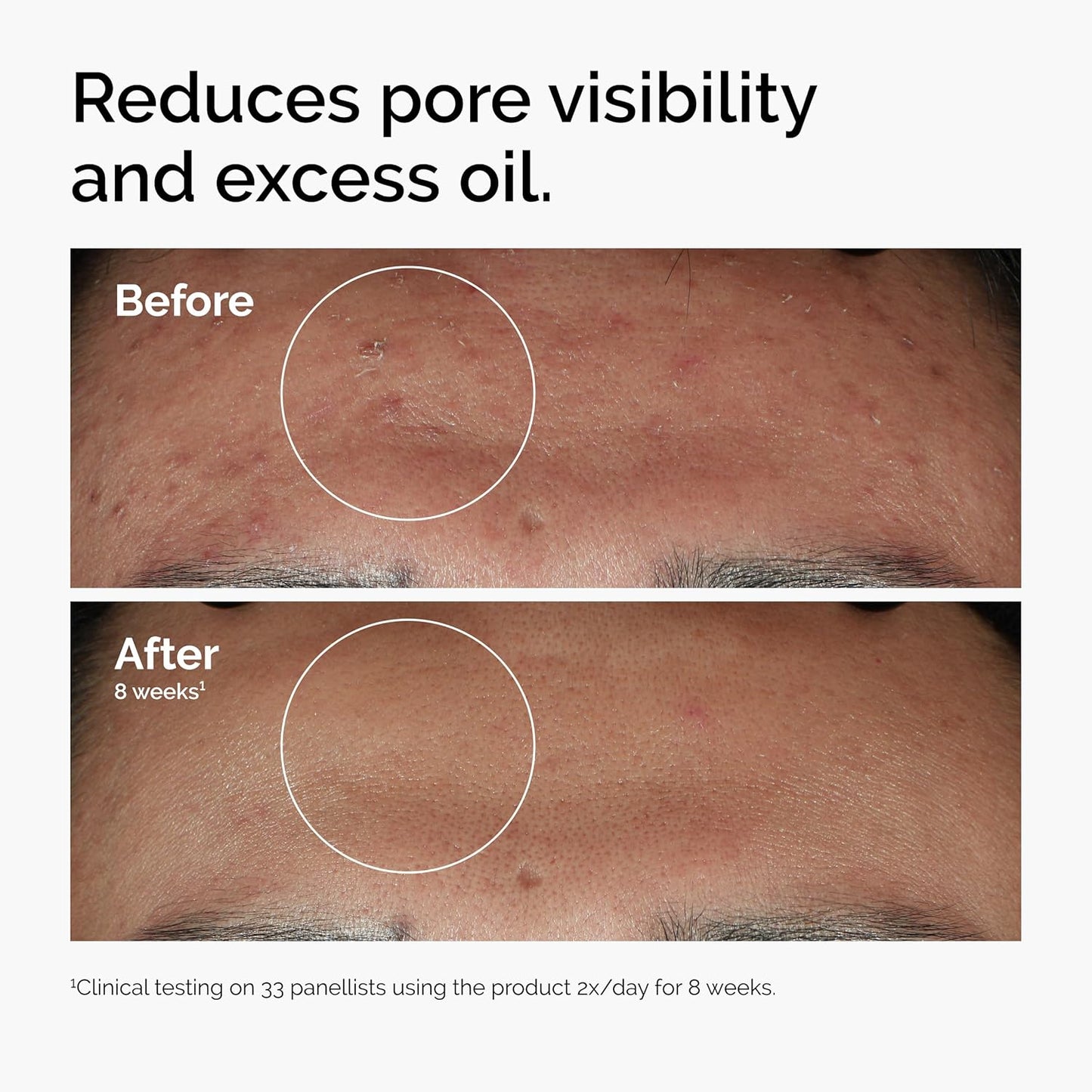 The Ordinary Serum Favorites Set – Hyaluronic Acid 2% + B5, Niacinamide 10% + Zinc 1%, Caffeine Solution 5% – Eye and Face Serums for Hydrating, Brightening & Pore-Minimizing Skin Care
