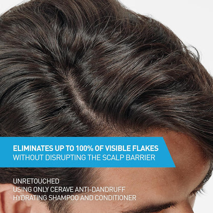 CeraVe Hydrating Anti Dandruff Shampoo, 1% Pyrithione Zinc Dandruff Treatment With Ceramides, Niacinamide & Hyaluronic Acid, Helps Eliminate Flakes & Provides Itchy Scalp Relief, Sulfate Free, 12 Oz