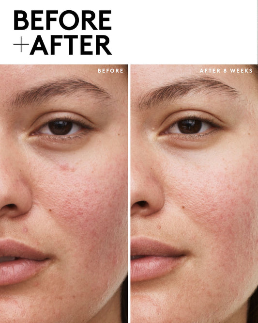 Fenty Skin Vault 5-Piece AM + PM Skincare Essentials with Mineral SPF