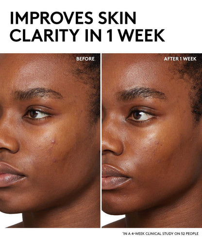 Fenty Skin Start’rs Full-Size Bundle: Oily Skin Edition
