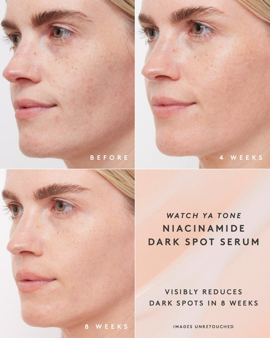 Watch Ya Tone Niacinamide Dark Spot Serum Refill