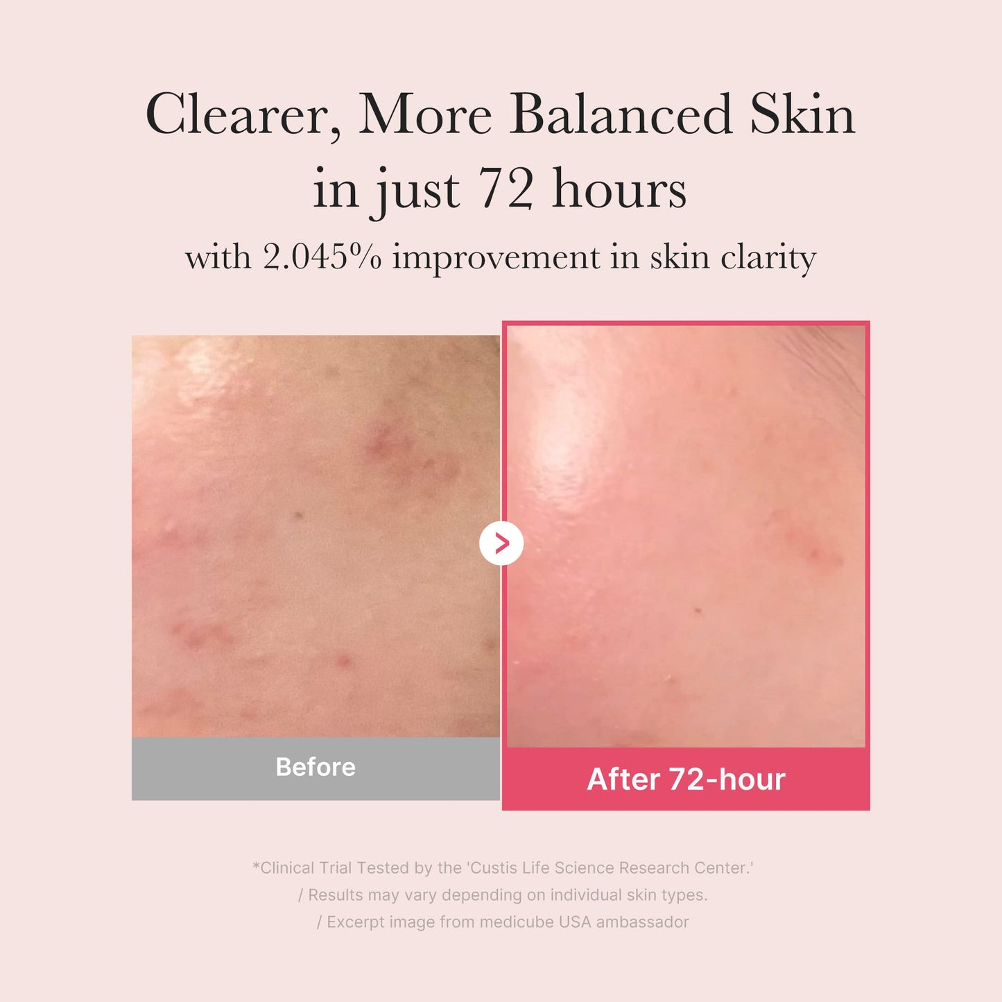 [Subscr.] TXA Niacinamide Serum